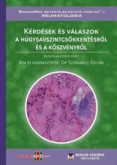 Kérdések és válaszok a húgysavszintcsökkentésről és a köszvényről