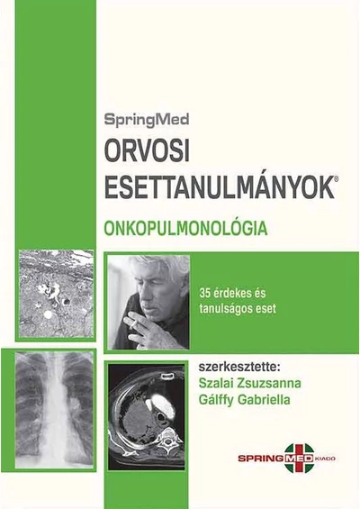 Onkopulmonológia - Orvosi Esettanulmányok
